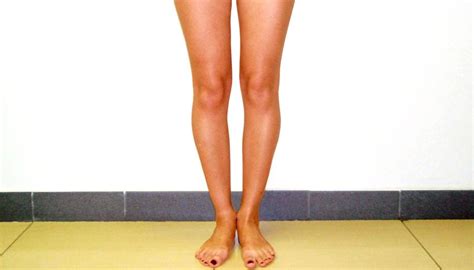 Кривые ноги у девушек