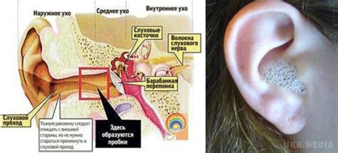 Можно ли чистить уши перекисью водорода
