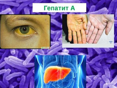 Признаки гепатита в