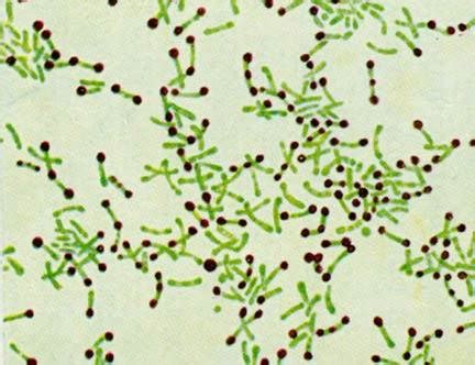 Eubacterium spp в мазке у женщин